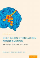 MCU_2017_Deep_Brain_Stimulation_Programming_Mechanisms,_Principles.pdf